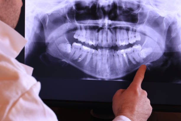 Best Urgent Tooth Repair  in Tioga, ND